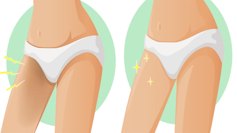 How To Get Rid Of Dark Inner Thighs 3 Simple Remedies